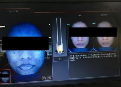皮膚檢測儀深度實測 Visia、美圖宜膚、A-one究竟哪家強？